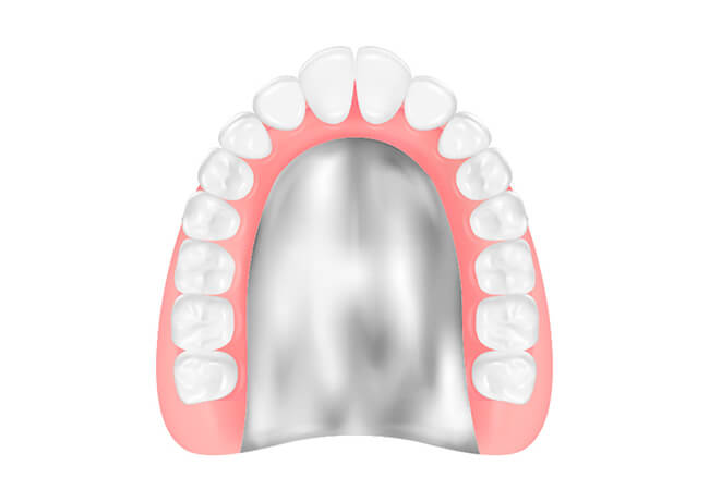 金属床義歯（コバルトクロム）