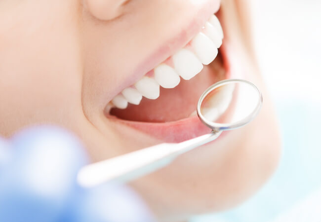 当院の歯のクリーニング（予防歯科）の特長