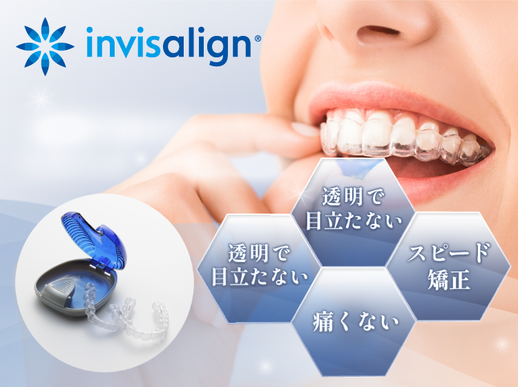 マウスピース矯正の注意点について